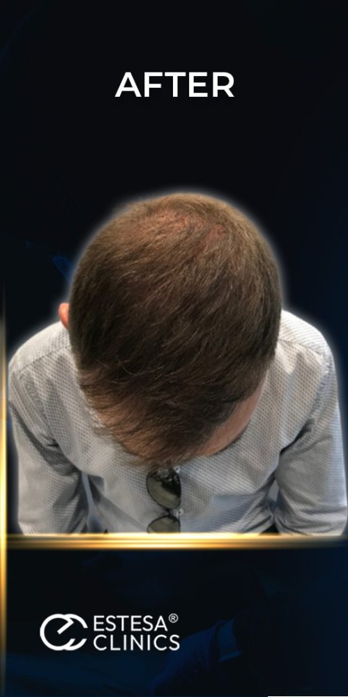 After treatment